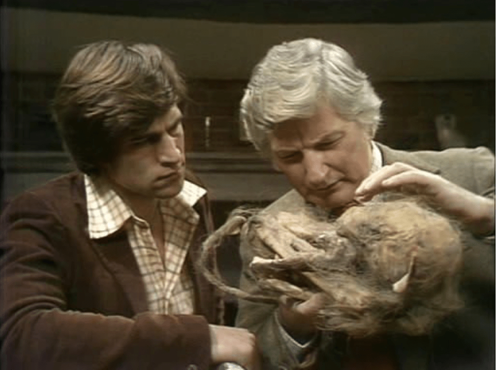 two men examine a hairy skull